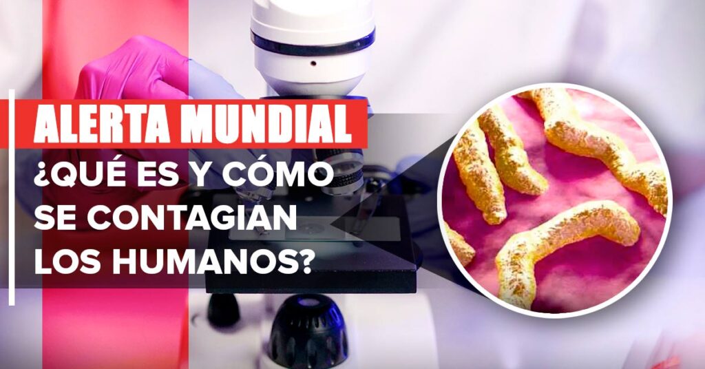 Virus de Marburgo: Aparecen casos del virus con 88% de mortalidad