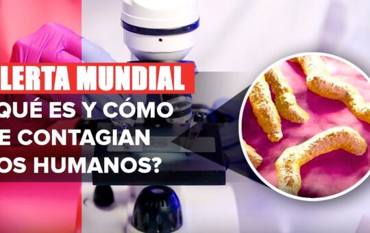 Virus de Marburgo: Aparecen casos del virus con 88% de mortalidad